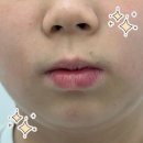원톤스킨 이미지