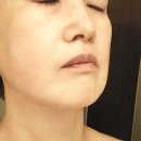 광교피부관리 탱탱한 탄력 챙기는 광교에스테틱