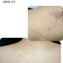 천연비누 자운고비누 맥주효모어자녹샴푸바 등 이미지