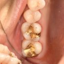 애플치과기공소 이미지