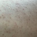 장력? 꼬에다 역기메다는 유튜버 하나 업로드 쇼크웨이브새끼가 개겨댜고 지랄병이야 ㅋ 이미지