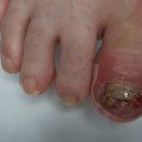 레푸스 감삼점&에이레네 이미지