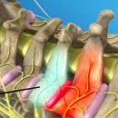 Re: Ultrasound-Guided Intervention in Cervical Spine 경추 초음파 진단 이미지