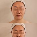 철강로 | 포항피부관리문덕피부관리 : 어본에스테틱에서 온다 리프팅 받은 후기