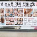 네일니케
