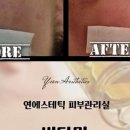 연에스테틱 네이버블로그