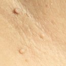 천호이지함피부과의원 이미지