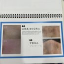 뷰티샵유에스에이 | 천안 불당동 토탈뷰티샵 뷰티에이 물방울 리프팅 솔직 후기