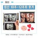 12 | 임신 10주 ~ 12주차 후기