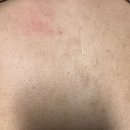 솔루션 | 신생아부터 성인까지 아토피 가려움 해결 아토샵 솔루션 후기