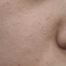 티에스 메디칼 이미지