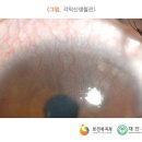 부산콘택트렌즈
