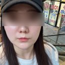 수원-0037 | [고운빛깔에스테틱 수원광교점] 예신 웨딩관리 경락 내돈내산 찐후기(전후비교)