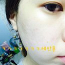 파에온메드 네이버블로그