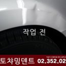 오토덴트 이미지