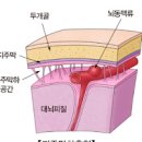 별다른 증상이 없는 뇌동맥류의 위협 지주막하출혈 위험성과 예방방법 이미지