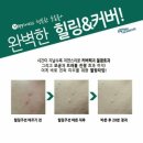 에이치필 이미지