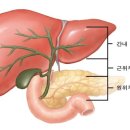 담낭 및 담관암(gallbladder cancer, cholangiocarcinoma) 이미지