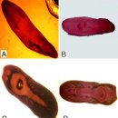 ﻿﻿Carmine염색 흡충류 Clinostomum과 Euclinostomum의 metacercaria 이미지