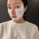 중앙로 권혁칠피부과 앞 | 대구 동성로 피부과 리쥬란 손주사 2cc 엠보 및 효과 후기