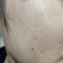 포마이뷰티 | 봄철 환절기보습템으로 강추하는 아임쏘리포마이스킨 후기!