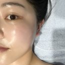 피부러움 | 합정역 에스테틱 피부관리 ‘피부러움’ 윤곽 리프팅 웨딩관리 후기