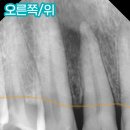 서원동-23 네이버블로그