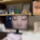 반포하늘안과빌딩 | 반포성형외과 울트라클리어 모공 여드름 흉터레이저 솔직 후기 / 통증, 전후, 경과 보고