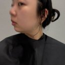 수원윤곽주사 효과 슬림해진 얼굴라인 정리 인계동 한의원 만족 추천 후기