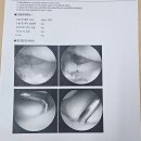 GS25당진고대점 | tfcc 주상월상 이제 양손 수술러(완료)가 되었어요