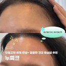 까치라인 노래연습장 | [건대왁싱 추천] 이마,헤어라인 잔털 왁싱 추천 누찌크