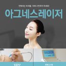 아그네스