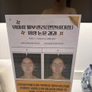 논현로2-3 | 예신 웨딩관리 준비하면서 오프숄더 도전하고 싶다면? 위뷰티 관리 4회차 솔직 후기(1,2,3회차 후기 포함)
