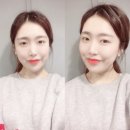 리샵필라테스 | 홍대피부관리,'로더뷰티샵-얼굴필라테스g'슬림한 얼굴라인관리 효과만점이에요!(전후사진)1회차
