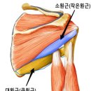 디클리셰 이미지