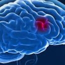 노스트한의원 이미지