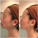 분당 정자역 윤곽관리 전문 셀리자치 후기 - 스파비알