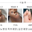 (주) 대상헬스케어 네이버블로그
