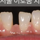 서울이로움치과의원 이미지