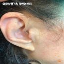 이화보청기 이미지