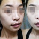 바른메디팜 이미지