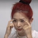 🍊 #1. 압구정 퀵매몰 후기 :: 수술 당일 ~ 4일차(실밥 제거)