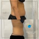 빛나리자 | 본질적인 자세 습관 비대칭 토탈 파악및 개선 남포동피부관리 빛나리자