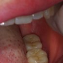 거성치과기공소 이미지