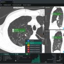 에스소프트 이미지