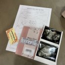 [임신일기] 4주차~6주차 증상 | 아기집,난황,첫심장소리확인, 임신확인증 (임산부등록, 뱃지발급 )