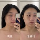에스떼라인 | 하남 일대일 맞춤 피부관리 전문 유정화에스떼라 후기