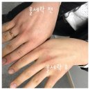 리프팅 끝판왕 [ 파이온텍 ] 울쎄락 으로 피부리셋 하기