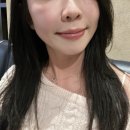 강남역피부과 추천 결절없는 고우리 콜라겐 스티뮬레이터 당일 일주일 경과