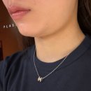 고슬림외과의원 | 강남역성형외과 내돈내산 지방분해주사 윤곽주사 원더핏주사로 얼굴라인교정 효과본 후기